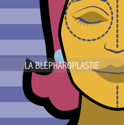 LA BLÉPHAROPLASTIE