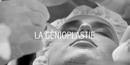 LA GÉNIOPLASTIE