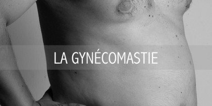 LA GYNÉCOMASTIE