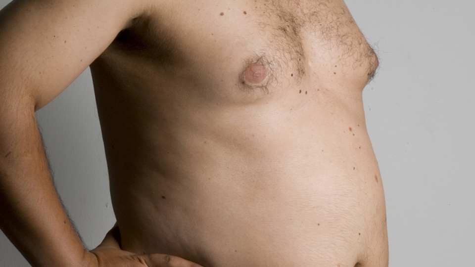 gynecomastie_fiche