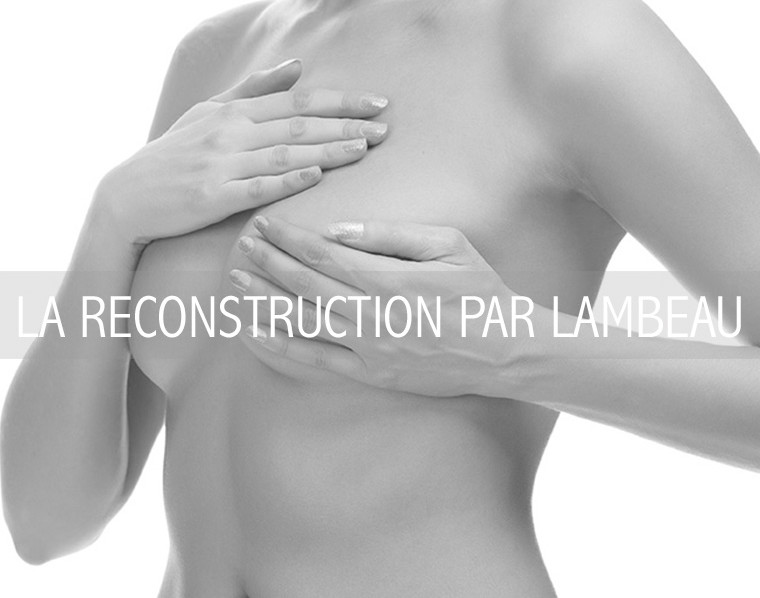 LA RECONSTRUCTION PAR LAMBEAU