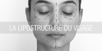 LA LIPOSTRUCTURE DU VISAGE