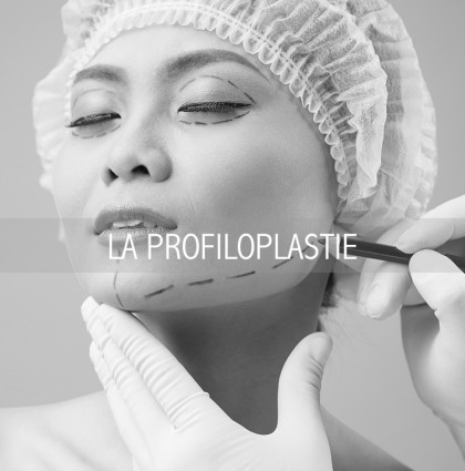 LA PROFILOPLASTIE