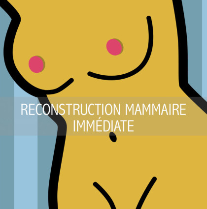 RECONSTRUCTION MAMMAIRE IMMÉDIATE