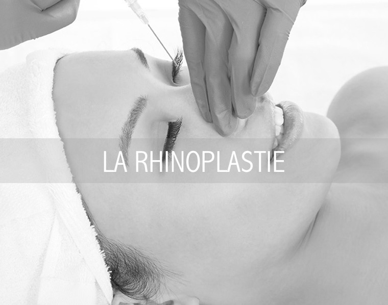 LA RHINOPLASTIE